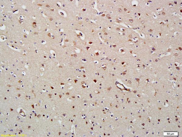 Immunohistochemistry (Formalin/PFA-fixed paraffin-embedded sections) - Anti-HDAC8 antibody (AB217702)