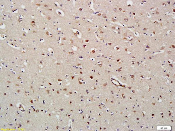 Immunohistochemistry (Formalin/PFA-fixed paraffin-embedded sections) - Anti-HDAC8 antibody (AB217702)