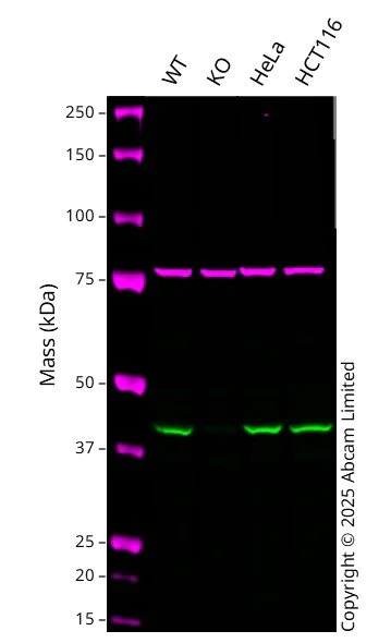 Western blot - Anti-HDAC8 antibody [EPR10338(2)] (AB187139)
