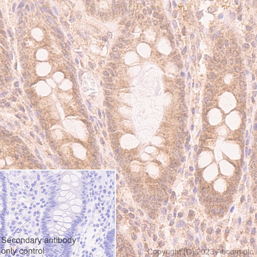 Immunohistochemistry (Formalin/PFA-fixed paraffin-embedded sections) - Anti-HDAC8 antibody [EPR27304-93] (ab315230), expandable thumbnail
