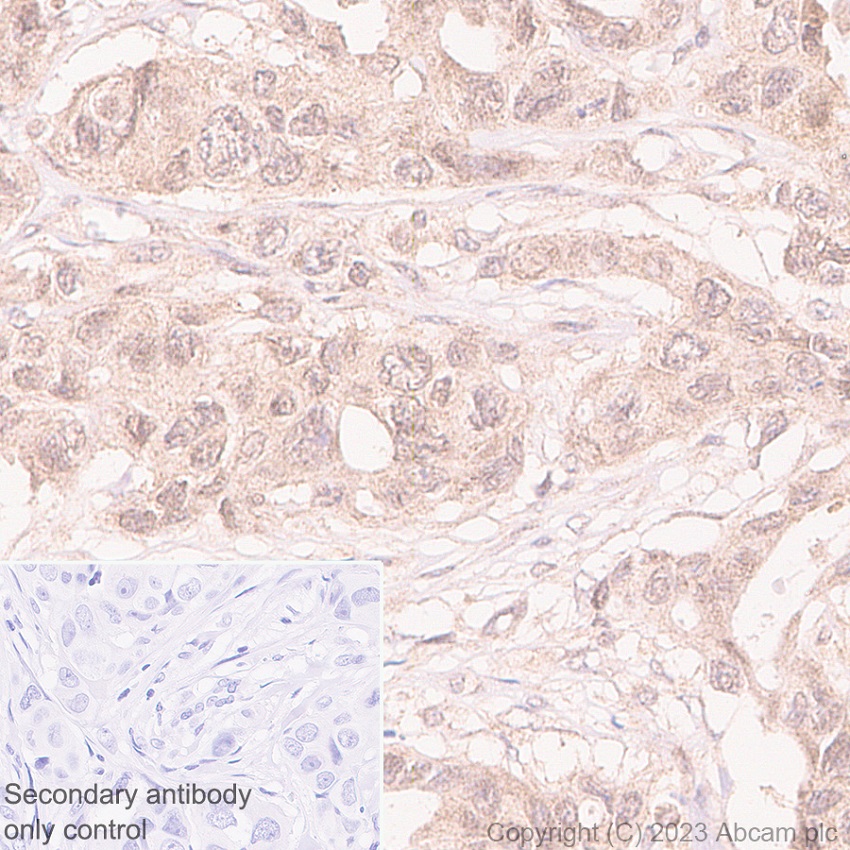 Immunohistochemistry (Formalin/PFA-fixed paraffin-embedded sections) - Anti-HDAC8 antibody [EPR27304-93] (AB315230), expandable thumbnail