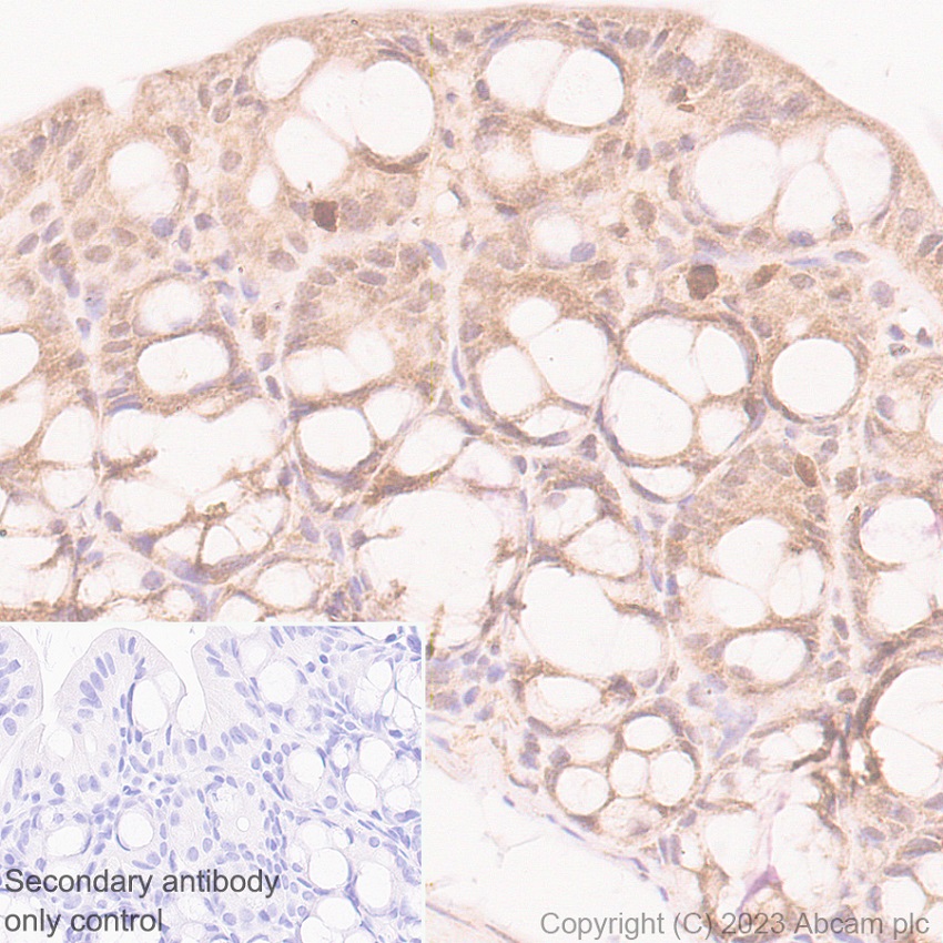 Immunohistochemistry (Formalin/PFA-fixed paraffin-embedded sections) - Anti-HDAC8 antibody [EPR27304-93] (AB315230), expandable thumbnail