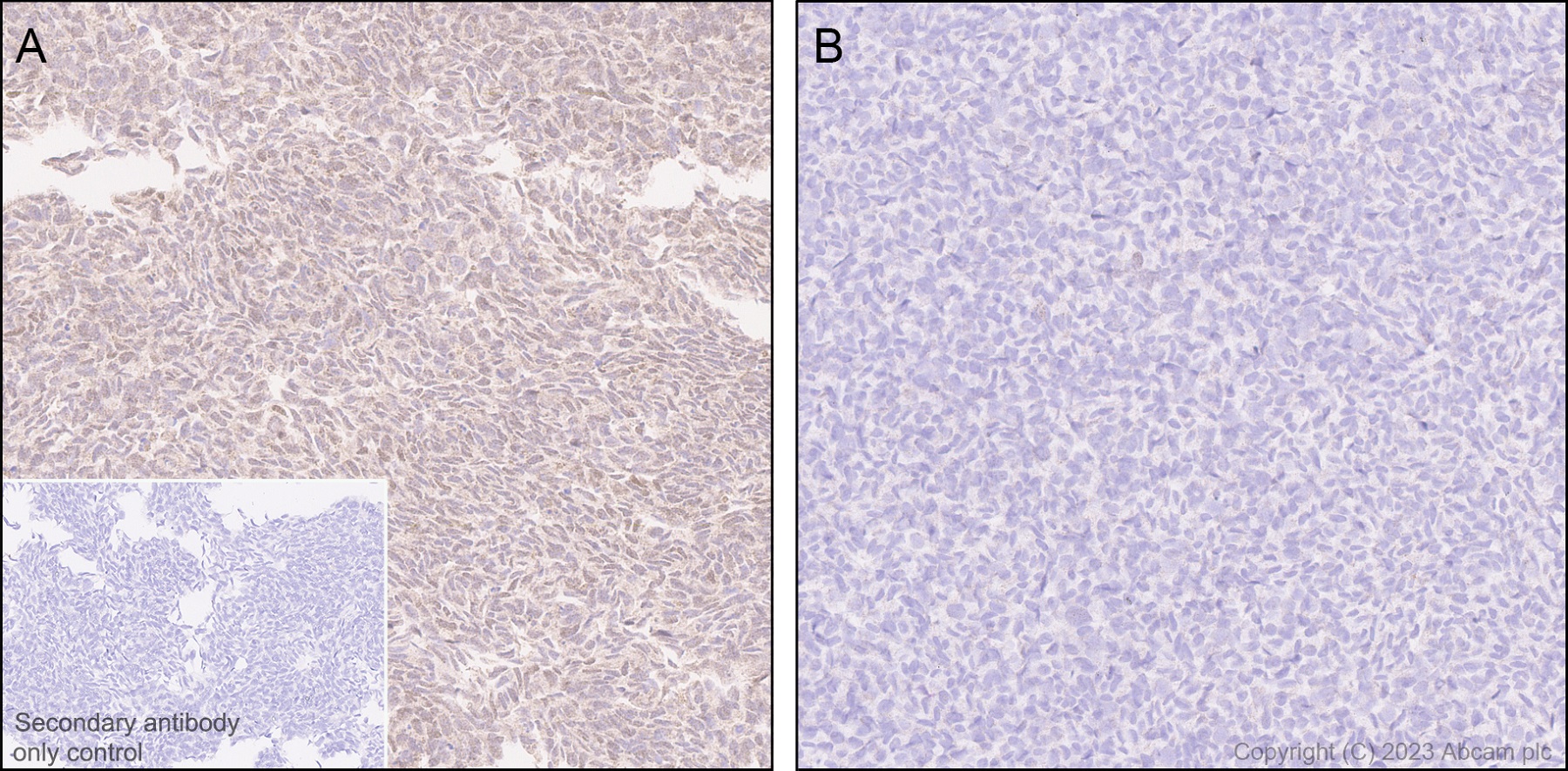 Immunohistochemistry (Formalin/PFA-fixed paraffin-embedded sections) - Anti-HDAC8 antibody [EPR27304-93] (AB315230), expandable thumbnail