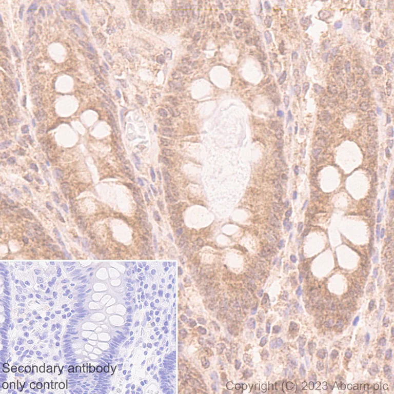 Immunohistochemistry (Formalin/PFA-fixed paraffin-embedded sections) - Anti-HDAC8 antibody [EPR27304-93] - BSA and Azide free (AB315231)