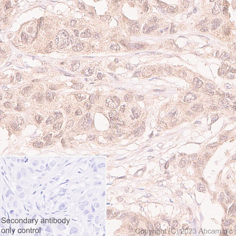 Immunohistochemistry (Formalin/PFA-fixed paraffin-embedded sections) - Anti-HDAC8 antibody [EPR27304-93] - BSA and Azide free (AB315231)