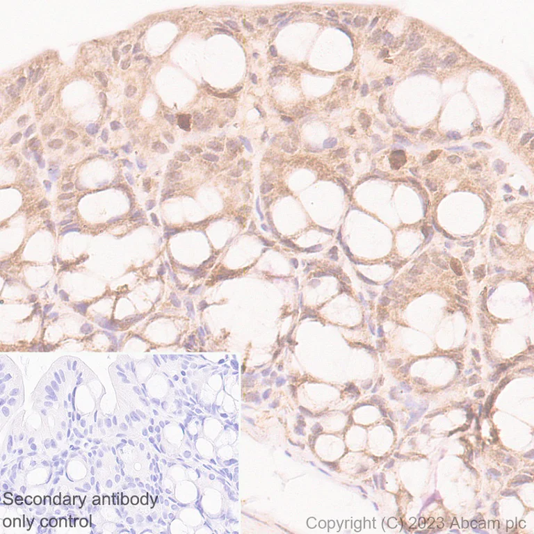Immunohistochemistry (Formalin/PFA-fixed paraffin-embedded sections) - Anti-HDAC8 antibody [EPR27304-93] - BSA and Azide free (AB315231)