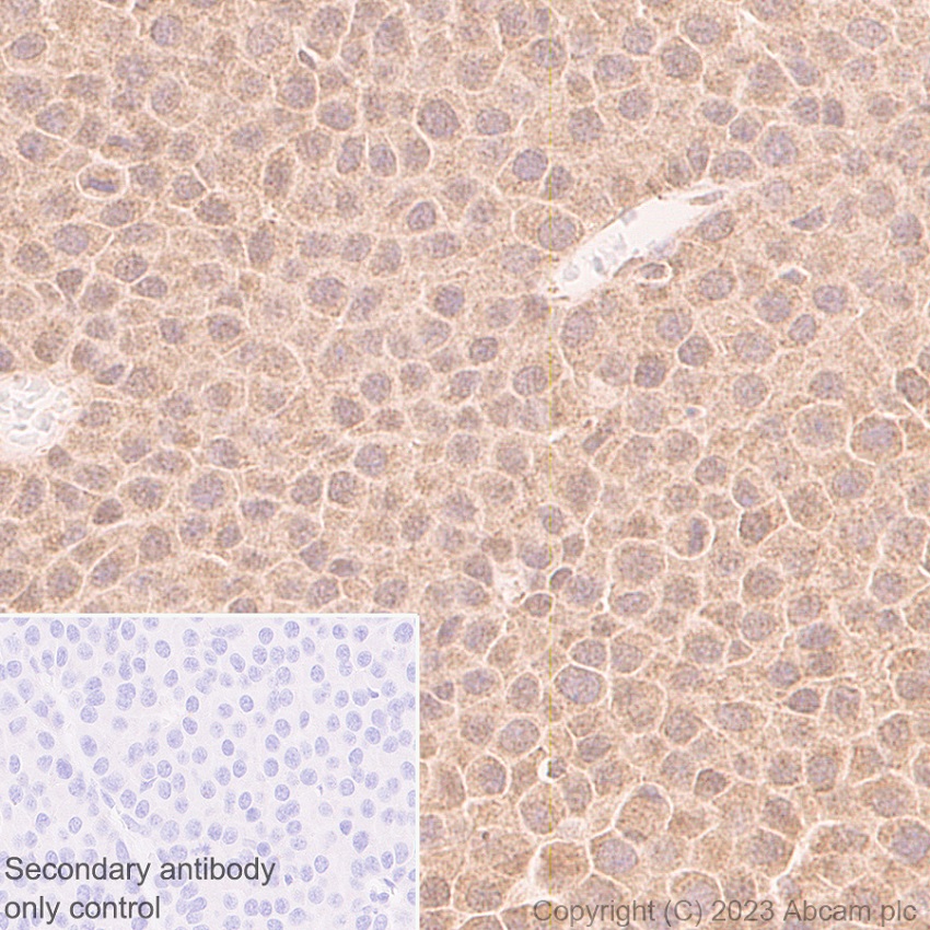 Immunohistochemistry (Formalin/PFA-fixed paraffin-embedded sections) - Anti-HDAC8 antibody [EPR27304-93] - BSA and Azide free (AB315231), expandable thumbnail