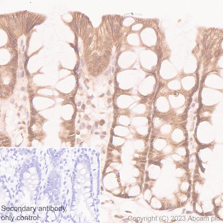 Immunohistochemistry (Formalin/PFA-fixed paraffin-embedded sections) - Anti-HDAC8 antibody [EPR27304-93] - BSA and Azide free (AB315231)
