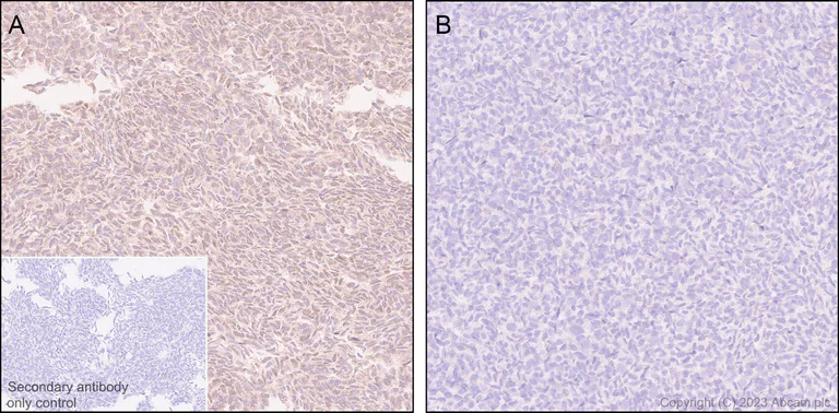 Immunohistochemistry (Formalin/PFA-fixed paraffin-embedded sections) - Anti-HDAC8 antibody [EPR27304-93] - BSA and Azide free (AB315231)