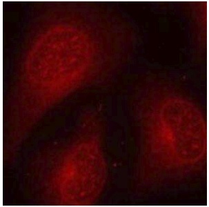 Immunocytochemistry/ Immunofluorescence - Anti-HDAC8 (phospho S39) antibody (AB195057)