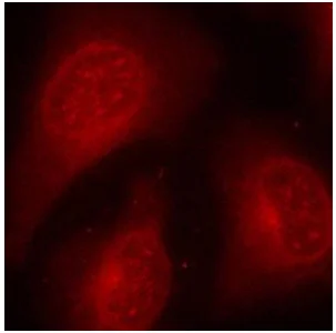 Immunocytochemistry/ Immunofluorescence - Anti-HDAC8 (phospho S39) antibody (AB195057)