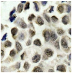 Immunohistochemistry (Formalin/PFA-fixed paraffin-embedded sections) - Anti-HDAC8 (phospho S39) antibody (AB195057)