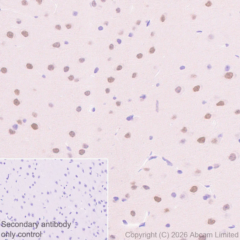 Immunohistochemistry (Formalin/PFA-fixed paraffin-embedded sections) - Anti-HDAC9 antibody [EPR30363-35] (AB326719)