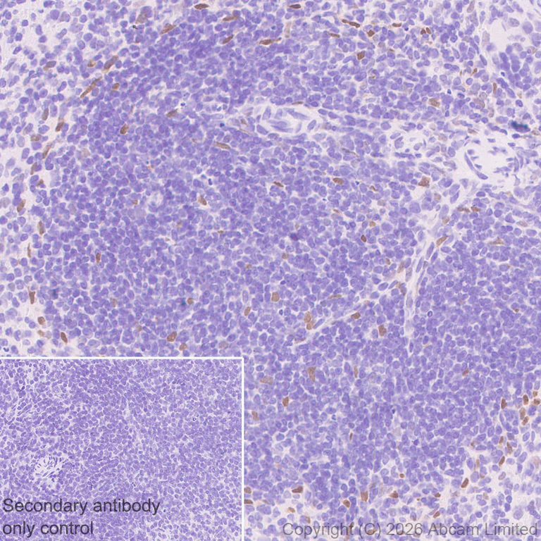Immunohistochemistry (Formalin/PFA-fixed paraffin-embedded sections) - Anti-HDAC9 antibody [EPR30363-35] (AB326719)