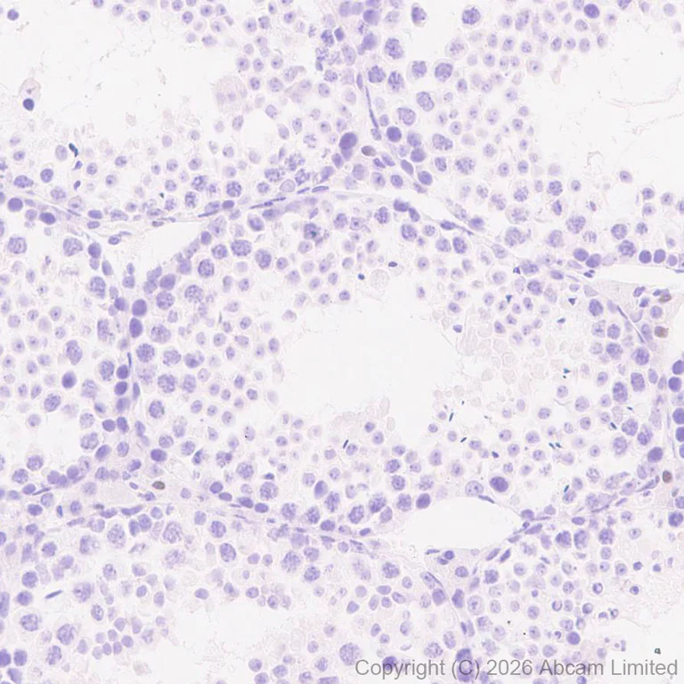 Immunohistochemistry (Formalin/PFA-fixed paraffin-embedded sections) - Anti-HDAC9 antibody [EPR30363-35] (AB326719)