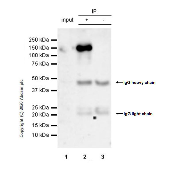Immunoprecipitation - Anti-HDAC9 antibody [EPR5223] (AB109446), expandable thumbnail
