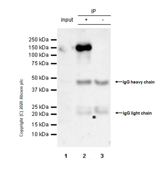 Immunoprecipitation - Anti-HDAC9 antibody [EPR5223] (AB109446)
