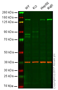 Western blot - Anti-HDAC9 antibody [EPR5223] - BSA and Azide free (AB239979)
