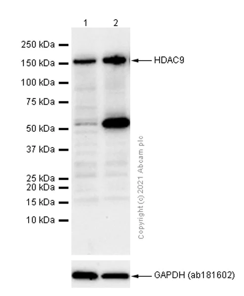 Western blot - Anti-HDAC9 antibody [EPR5223] - BSA and Azide free (AB239979)