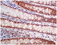 Immunohistochemistry (Formalin/PFA-fixed paraffin-embedded sections) - Anti-HDGF antibody [EPR7898] (AB128921)