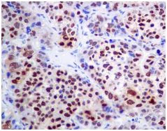 Immunohistochemistry (Formalin/PFA-fixed paraffin-embedded sections) - Anti-HDGF antibody [EPR7898] - BSA and Azide free (AB248221)