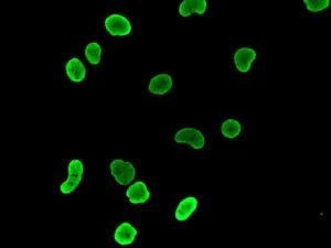 Immunocytochemistry/ Immunofluorescence - Anti-HDGF antibody [EPR7899] (AB131046)