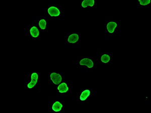 Immunocytochemistry/ Immunofluorescence - Anti-HDGF antibody [EPR7899] - BSA and Azide free (AB248356), expandable thumbnail