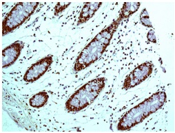 Immunohistochemistry (Formalin/PFA-fixed paraffin-embedded sections) - Anti-HDGF antibody [EPR7899] - BSA and Azide free (AB248356), expandable thumbnail