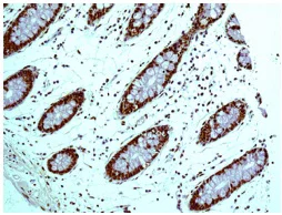 Immunohistochemistry (Formalin/PFA-fixed paraffin-embedded sections) - Anti-HDGF antibody [EPR7899] - BSA and Azide free (AB248356)