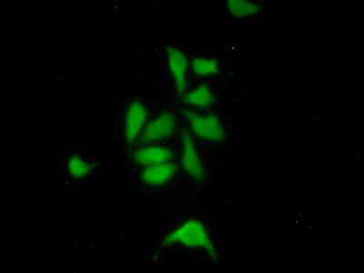 Immunocytochemistry/ Immunofluorescence - Anti-HDLBP antibody (AB232896), expandable thumbnail