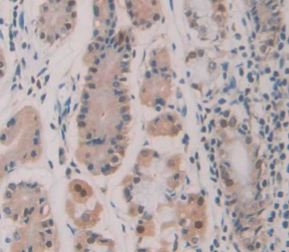 Immunohistochemistry (Formalin/PFA-fixed paraffin-embedded sections) - Anti-HDLBP antibody (AB232896), expandable thumbnail