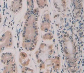 Immunohistochemistry (Formalin/PFA-fixed paraffin-embedded sections) - Anti-HDLBP antibody (AB232896)