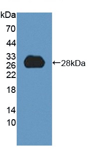Western blot - Anti-HDLBP antibody (AB232896), expandable thumbnail