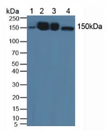 Western blot - Anti-HDLBP antibody (AB232896)