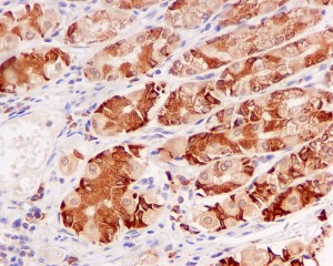 Immunohistochemistry (Formalin/PFA-fixed paraffin-embedded sections) - Anti-HDLBP antibody [EPR5267] (AB109324)