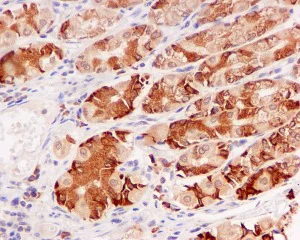 Immunohistochemistry (Formalin/PFA-fixed paraffin-embedded sections) - Anti-HDLBP antibody [EPR5267] (AB109324)