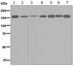 Western blot - Anti-HDLBP antibody [EPR5268] (AB133594)