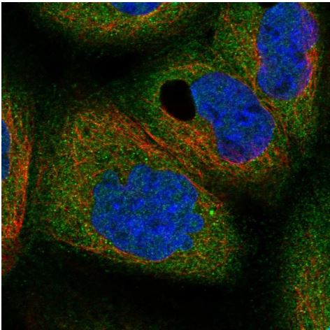 Immunocytochemistry/ Immunofluorescence - Anti-HE4 antibody (AB273130), expandable thumbnail