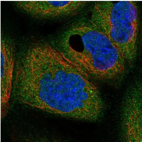 Immunocytochemistry/ Immunofluorescence - Anti-HE4 antibody (AB273130)