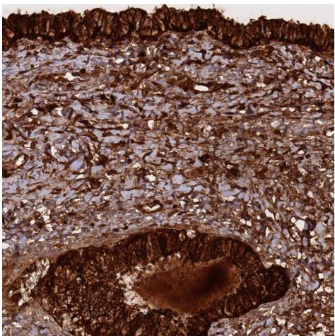 Immunohistochemistry (Formalin/PFA-fixed paraffin-embedded sections) - Anti-HE4 antibody (AB273130), expandable thumbnail