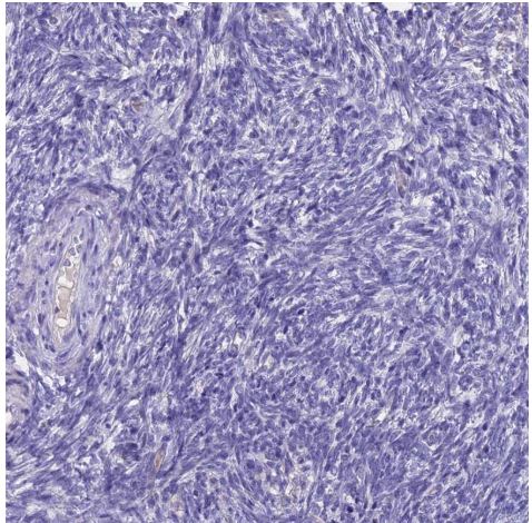 Immunohistochemistry (Formalin/PFA-fixed paraffin-embedded sections) - Anti-HE4 antibody (AB273130), expandable thumbnail