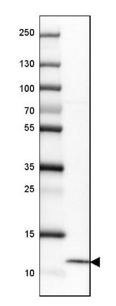 Western blot - Anti-HE4 antibody (AB273130), expandable thumbnail