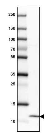 Western blot - Anti-HE4 antibody (AB273130)