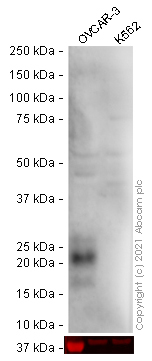 Western blot - Anti-HE4 antibody (AB273130), expandable thumbnail