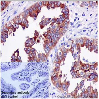 Immunohistochemistry (Formalin/PFA-fixed paraffin-embedded sections) - Anti-HE4 antibody [EPR16658] - BSA and Azide free (AB240357)