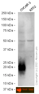 Western blot - Anti-HE4 antibody [EPR16658] - BSA and Azide free (AB240357)