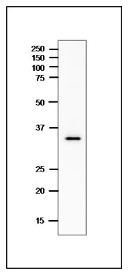 Western blot - Anti-Heat-labile enterotoxin B chain antibody (AB243102)