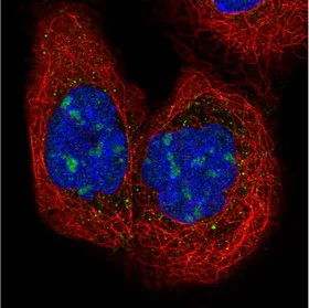 Immunocytochemistry/ Immunofluorescence - Anti-HEATR1 antibody (AB150968)