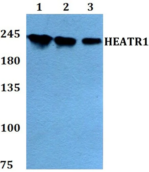 Western blot - Anti-HEATR1 antibody (AB200693)
