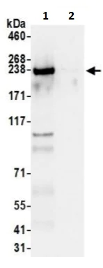 Immunoprecipitation - Anti-HEATR1 antibody (AB241610)